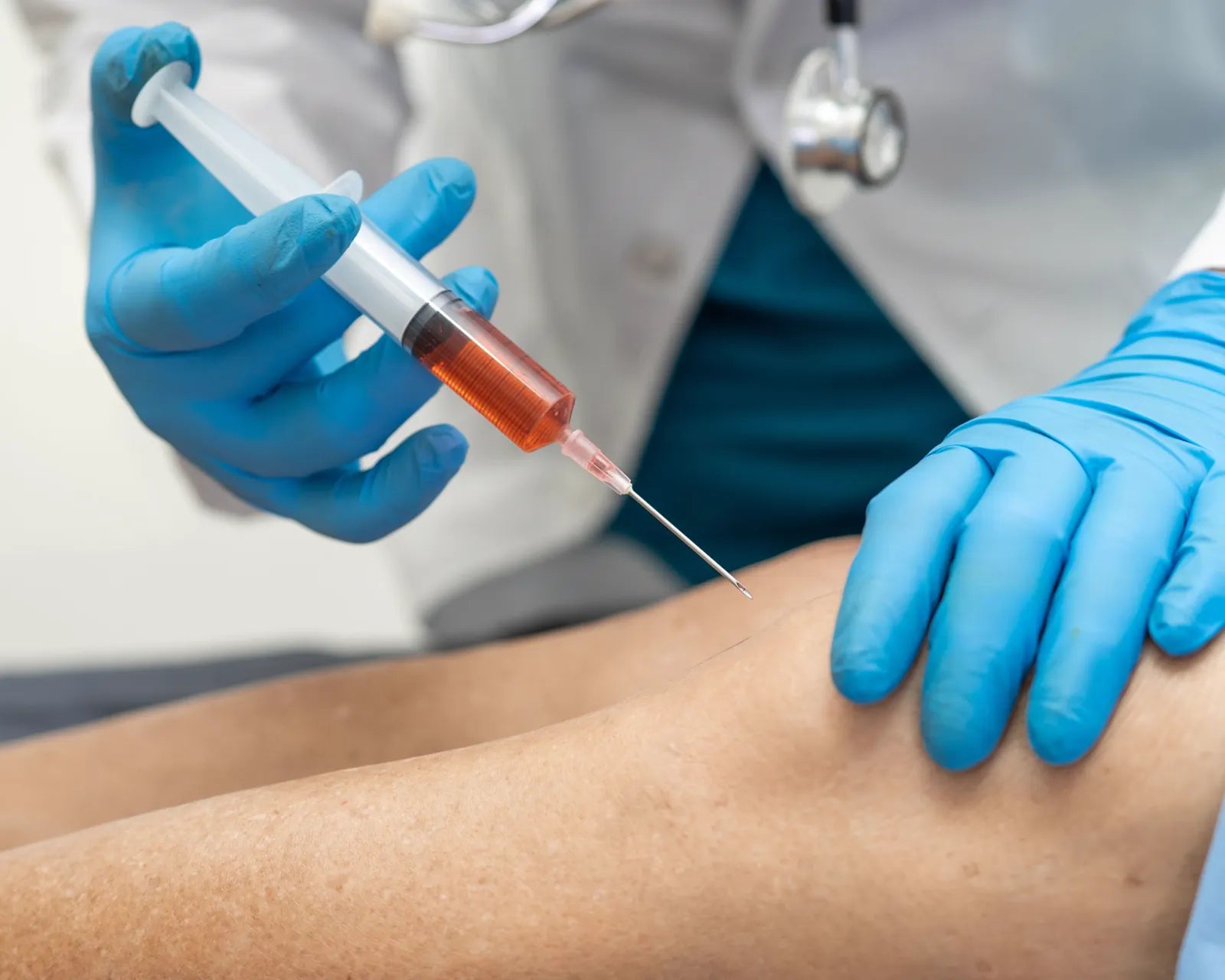 PRP injection into the knee